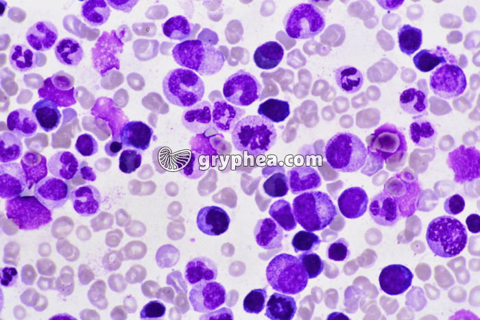 Moelle osseuse x400 - gryphea.com